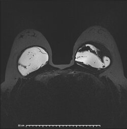 image-Patient_32].jpg