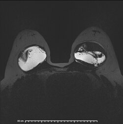image-Patient_33].jpg