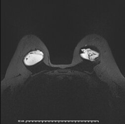 image-Patient_34].jpg
