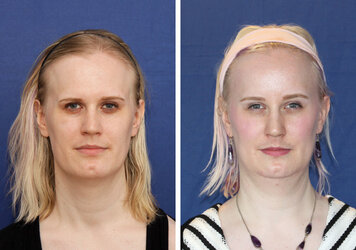 alexandra-skimmeland-front.jpg alexandra-skimmeland-front.jpg