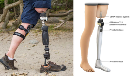 prostheticPROMO_1.5fea4d31945eb.png