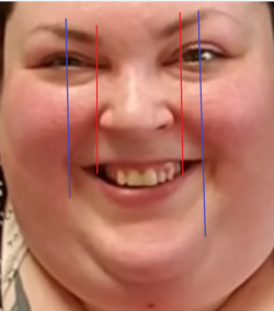 jaw.PNG