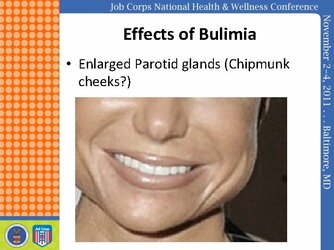 bulimia2.jpeg