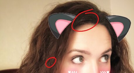 Lice.jpg