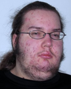 Neckbeard_%28man%29.png