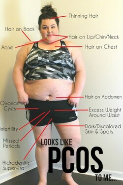 PCOS-Symptoms-683x1024.jpg