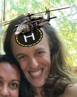 lol forehead.jpg