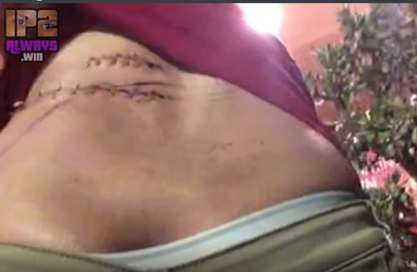 stabwounds.png