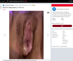 Erect_dickstump2.jpg