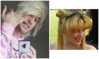 teethcompare.jpeg