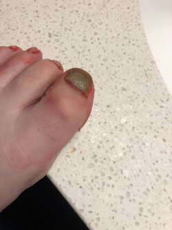 foot.jpg