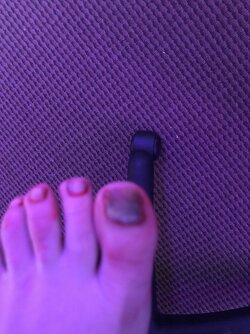 Disgusting_nails.jpeg.jpeg