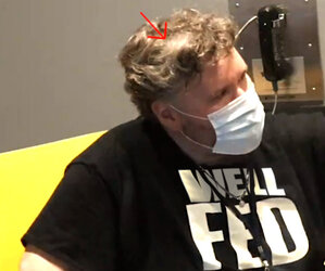 wellfed_bald_spot.jpg