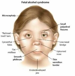 abnormal-facial-398x400.jpg