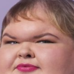 Tammy Slaton Forehead.png