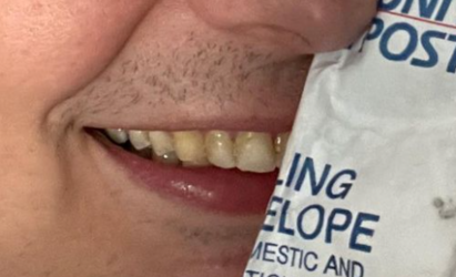 teeth2.PNG