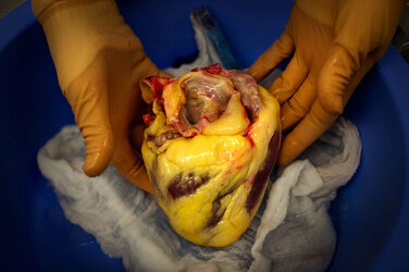 fat heart.jpg