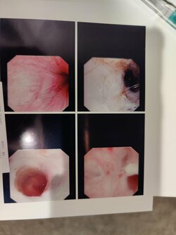 urethra.jpg