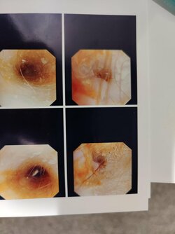 urethra2.jpg