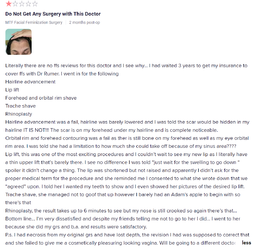 ffs.png
