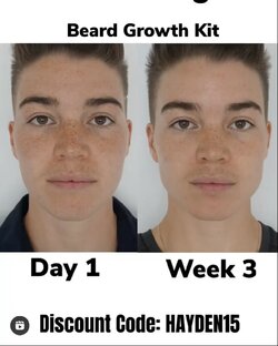 beardgrowth.jpeg