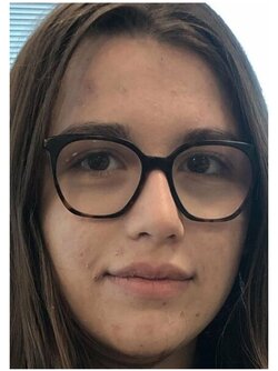 Scabbyface3.jpg