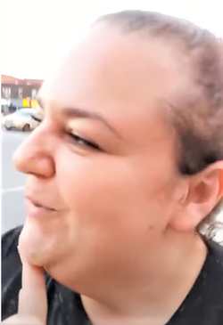 Potato Pattern Baldness.png