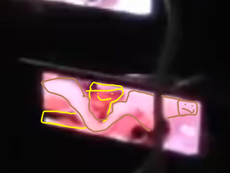 yop.png