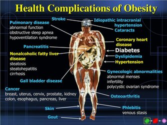 health-complications-of-obesity-l.jpg