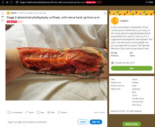 Medical_gore.jpg