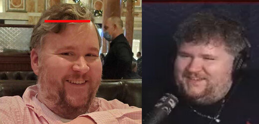 Ralph Hairline HAHAHA.jpg