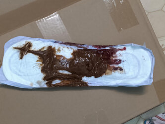 Poop_vagina_pad.jpg
