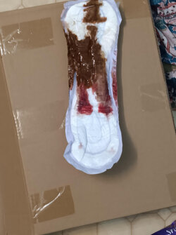 Poop_vagina_pad2.jpg