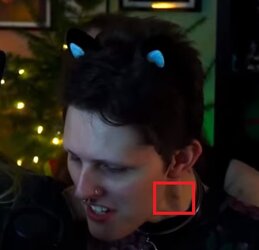 DoeScars01.jpg