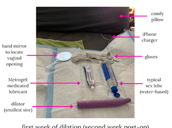 dilator setup.png