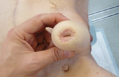 uro-may21-gender-fig-6.jpg