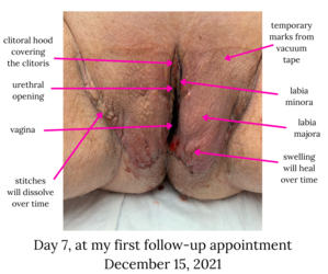 day 7 - dec 15 - full vulva.png