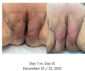 comparison - vulva on days 7 and 15.png