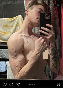 bulimicballerinaftm.jpg