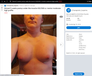 Pec_impants1.jpg