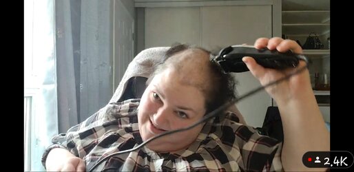 Baldbaldy.jpg