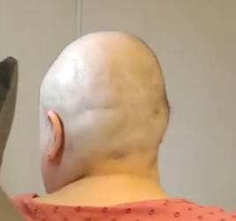 lumpy.png