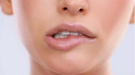 bittenlips.PNG