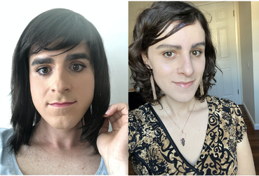 Before After.png