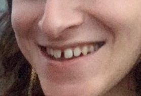 teef.PNG