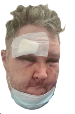 ralphhurt.png