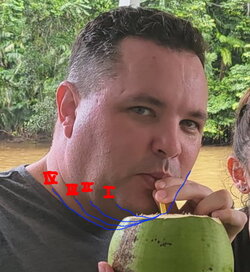 patrick fourchinlinson.jpg