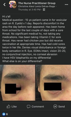 15-yo-vesicular-rash.jpg