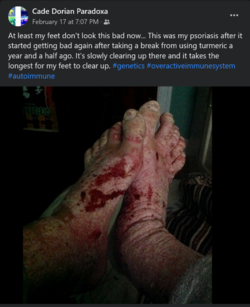 Screenshot 2022-03-03 at 20-00-38 Cade Dorian Paradoxa Facebook.png
