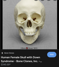 boneclones.png